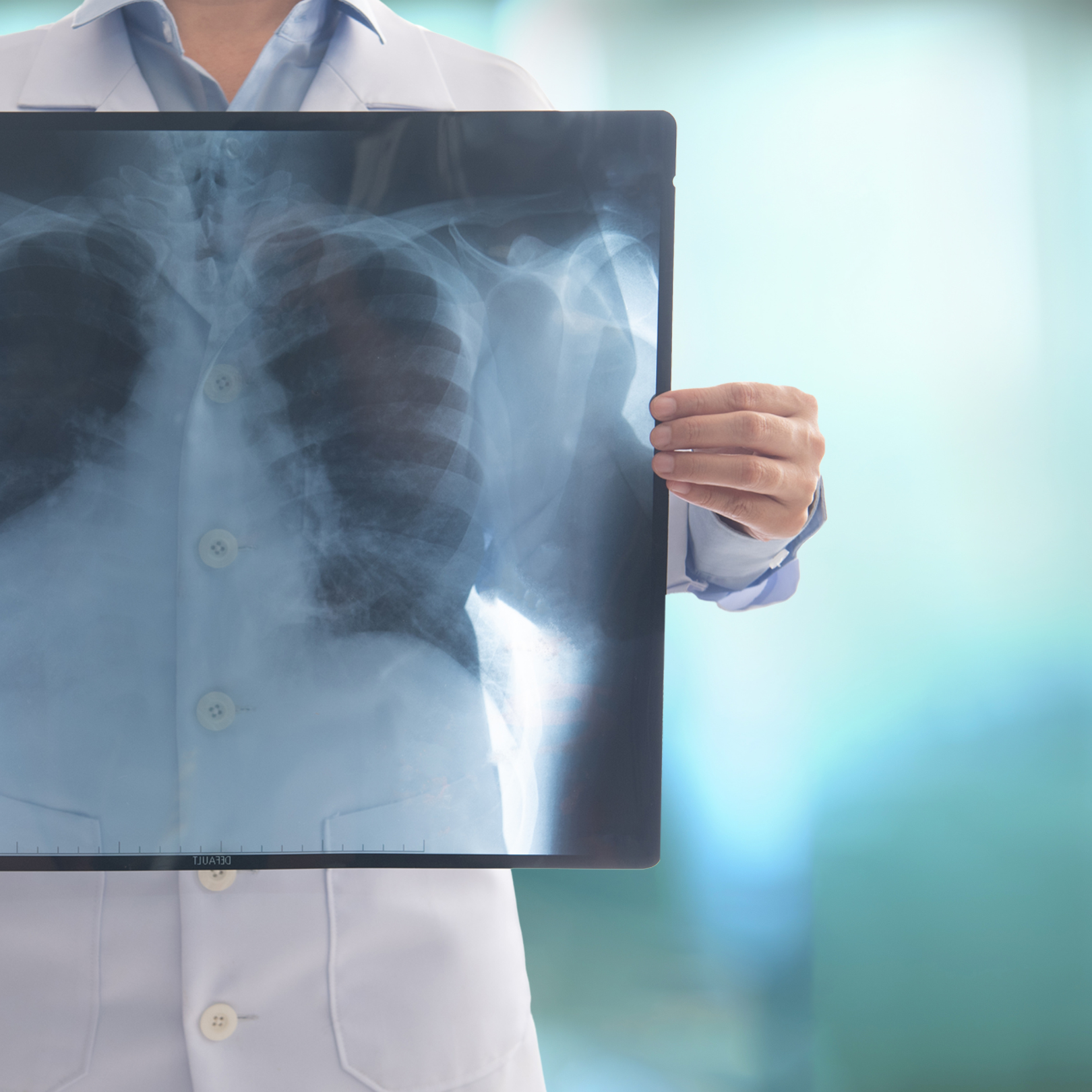 Firmada Convenção Coletiva dos Tecnólogos, Técnicos e Aux. em Radiologia
